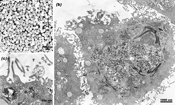 Scanning and transmission electron micrographs of silica nanoparticles with 60 nm diameters 