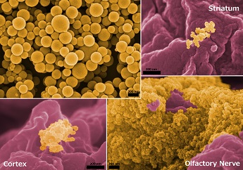 False color image of gelatin nanoparticles in various regions of a rat brain following intranasal administration