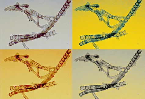 This micrograph shows four different color versions of a bamboo-like structure of nitrogen-doped carbon nanotubes for the treatment of cancer. 