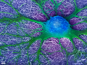 False color image of an embryonic neural cell derived from the mouse spinal cord and cultured on a synthetic nanofiber gel