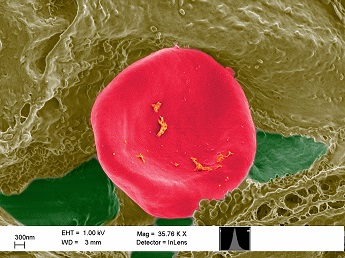 A single red blood cell (erythrocyte) is visible escaping out of a blood vessel in a porcine skin sample exposed to cerium oxide nanoparticles