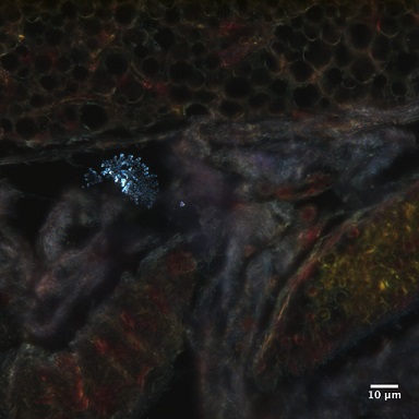 metal oxide nanoparticles in lymph node tissue