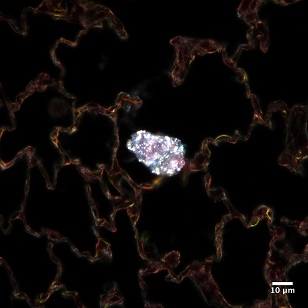 nanoparticles in rat lung tissue