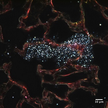 metal oxide nanoparticles in lung tissue