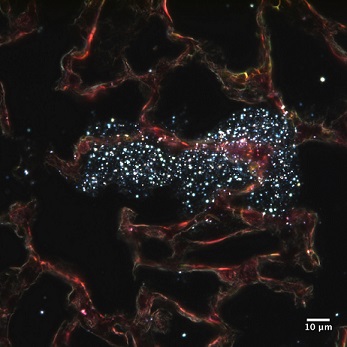 metal oxide nanoparticles in lung tissue