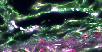 Silicon dioxide nanoparticles bright up next to a hair follicle in the dermal layer
