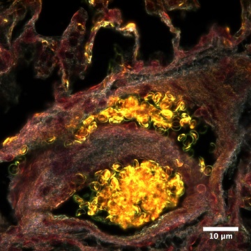 darkfield microscope image of blood vessels in a lung
