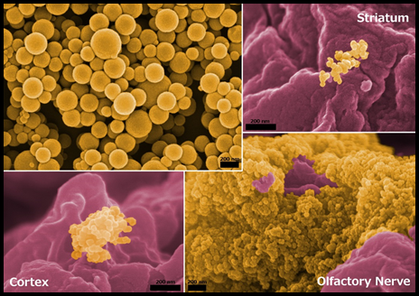 Gelatin particles in brain contest winner