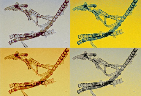 This micrograph shows four different color versions of a bamboo-like structure of nitrogen-doped carbon nanotubes for the treatment of cancer. 